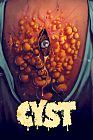 Cyst 2020